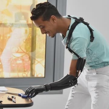 Person using a 3D printed prosthetic arm
